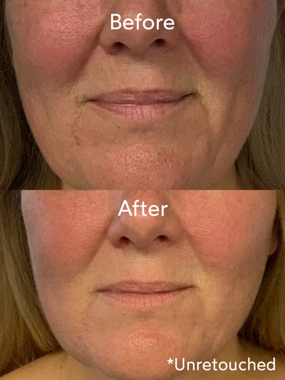 Renew Repair Nightly Treatment Before & After-True Botanicals