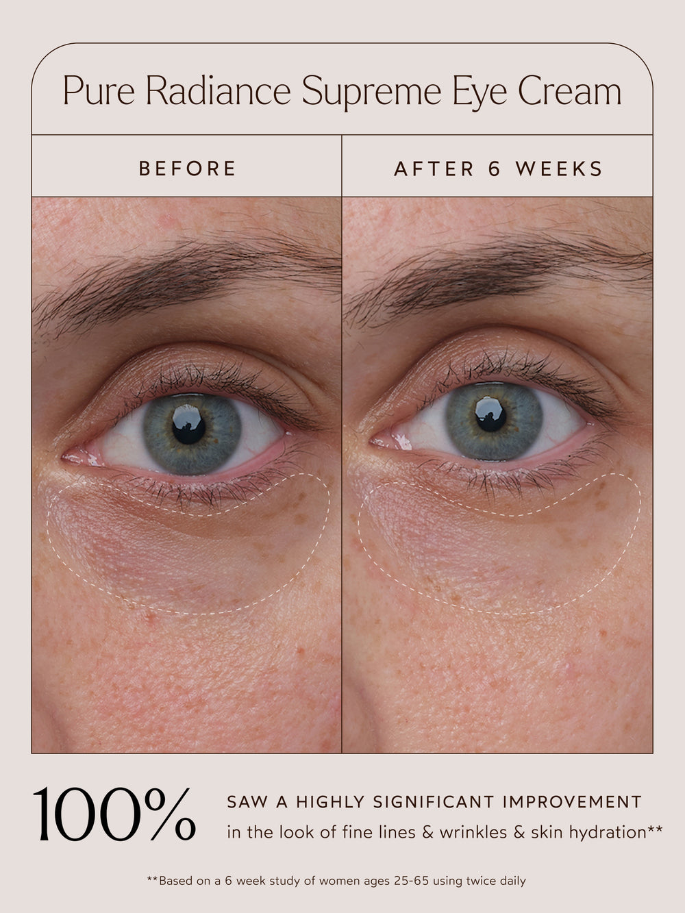 Pure Radiance Supreme Eye Cream