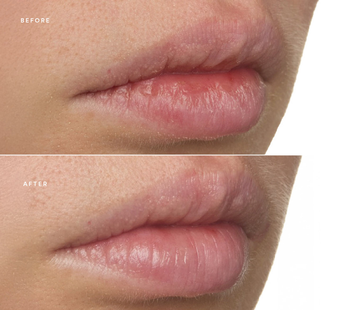 Before and after of lip images.