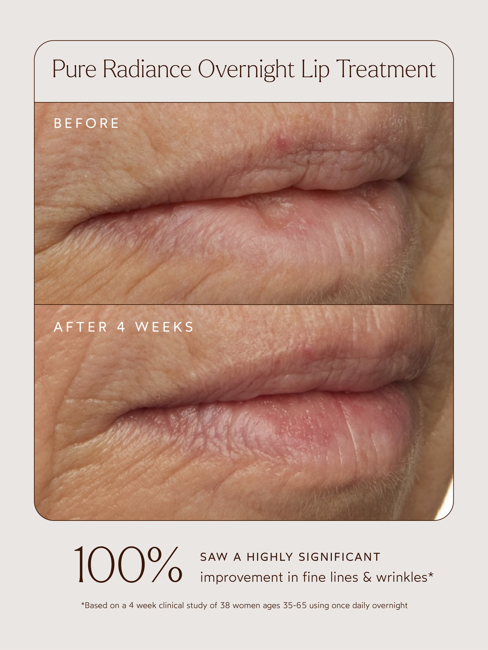 Before and after of lip images.