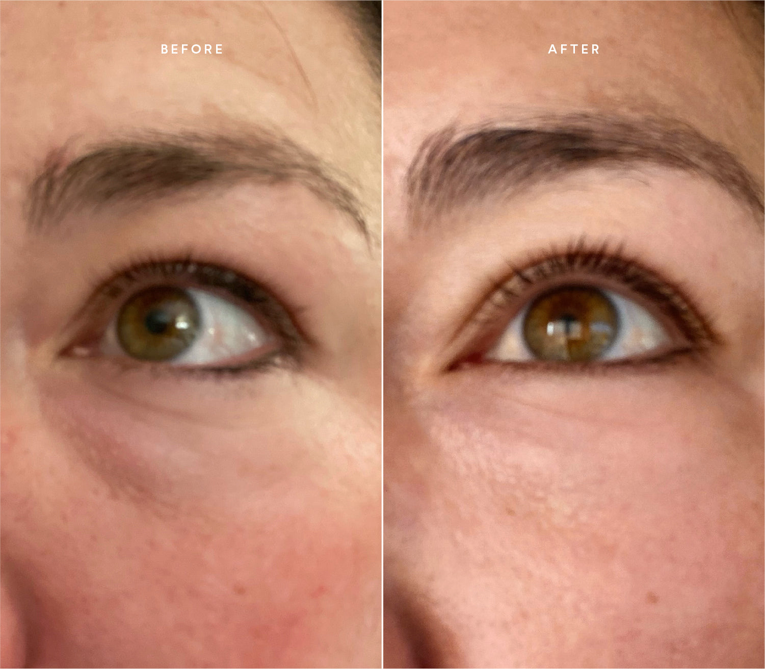 Before and after comparison showing smoother skin texture and reduced fine lines around the eye area.