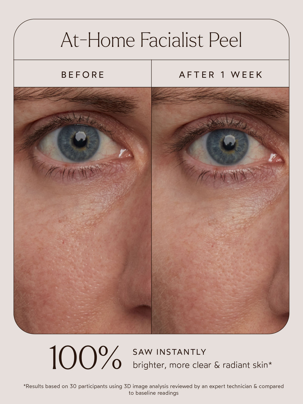 Before-and-after comparison of the At-Home Facialist Peel highlighting under-eye and cheek skin texture. The "Before" image shows dull and uneven skin, while the "After 1 Week" image reveals brighter, clearer, and more radiant skin. Accompanying text states: "100% saw instantly brighter, more clear & radiant skin." A note clarifies: "Results based on 30 participants using 3D image analysis reviewed by an expert technician & compared to baseline readings."