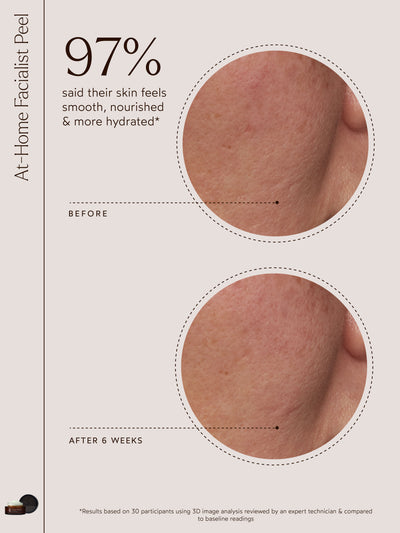 An informational graphic for the At-Home Facialist Peel featuring text that reads: "97% said their skin feels smooth, nourished & more hydrated*." Two side-by-side magnified images labeled "Before" and "After 6 Weeks" show visible improvements in skin texture and hydration. The text at the bottom states: "*Results based on 30 participants using 3D image analysis reviewed by an expert technician & compared to baseline readings." A small product image of the At-Home Facialist Peel is featured in the lower lef