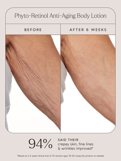 Side-by-side "Before" and "After 6 Weeks" images of arm skin treated with Phyto-Retinol Anti-Aging Body Lotion. The "Before" photo shows visible wrinkles and crepey texture, while the "After 6 Weeks" photo displays smoother, more refined skin. The text reads: "94% said their crepey skin, fine lines & wrinkles improved*" with a note that the data is based on a 6-week clinical trial of 33 women aged 35–65 using the product as needed.
