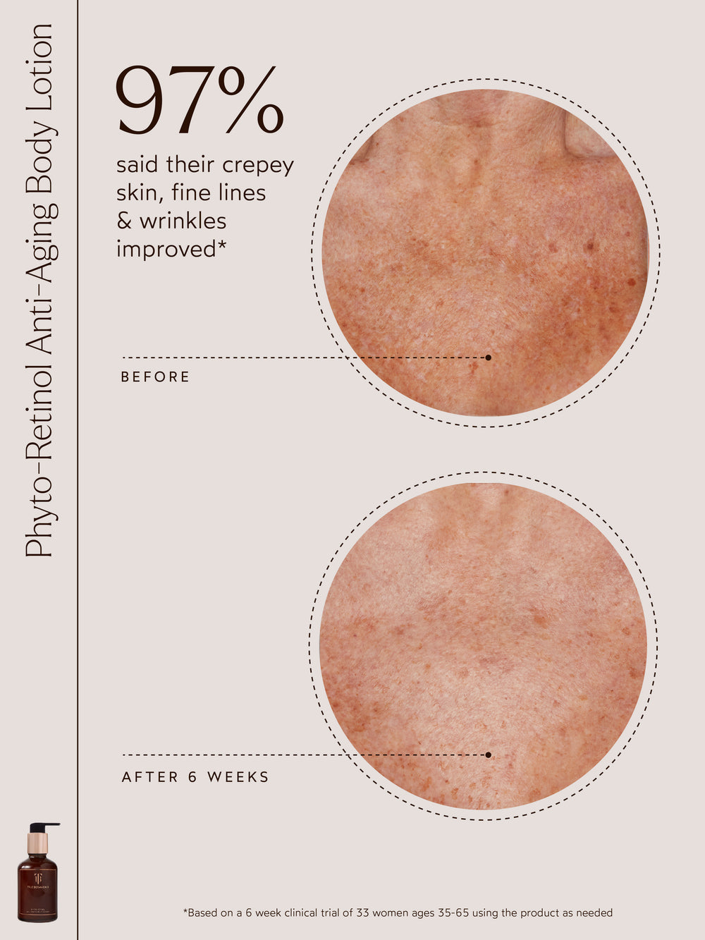 In a six-week clinical trial of Phyto-Retinol Anti-Aging Body Lotion, 97% of participants noticed significant improvement in crepey skin, fine lines, and wrinkles. The before-and-after images reveal smoother and more even skin texture, particularly in areas prone to visible aging. This study included 33 women aged 35–65 who used the product as needed, showcasing its efficacy in enhancing skin appearance and promoting a youthful glow.