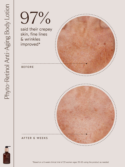 In a six-week clinical trial of Phyto-Retinol Anti-Aging Body Lotion, 97% of participants noticed significant improvement in crepey skin, fine lines, and wrinkles. The before-and-after images reveal smoother and more even skin texture, particularly in areas prone to visible aging. This study included 33 women aged 35–65 who used the product as needed, showcasing its efficacy in enhancing skin appearance and promoting a youthful glow.