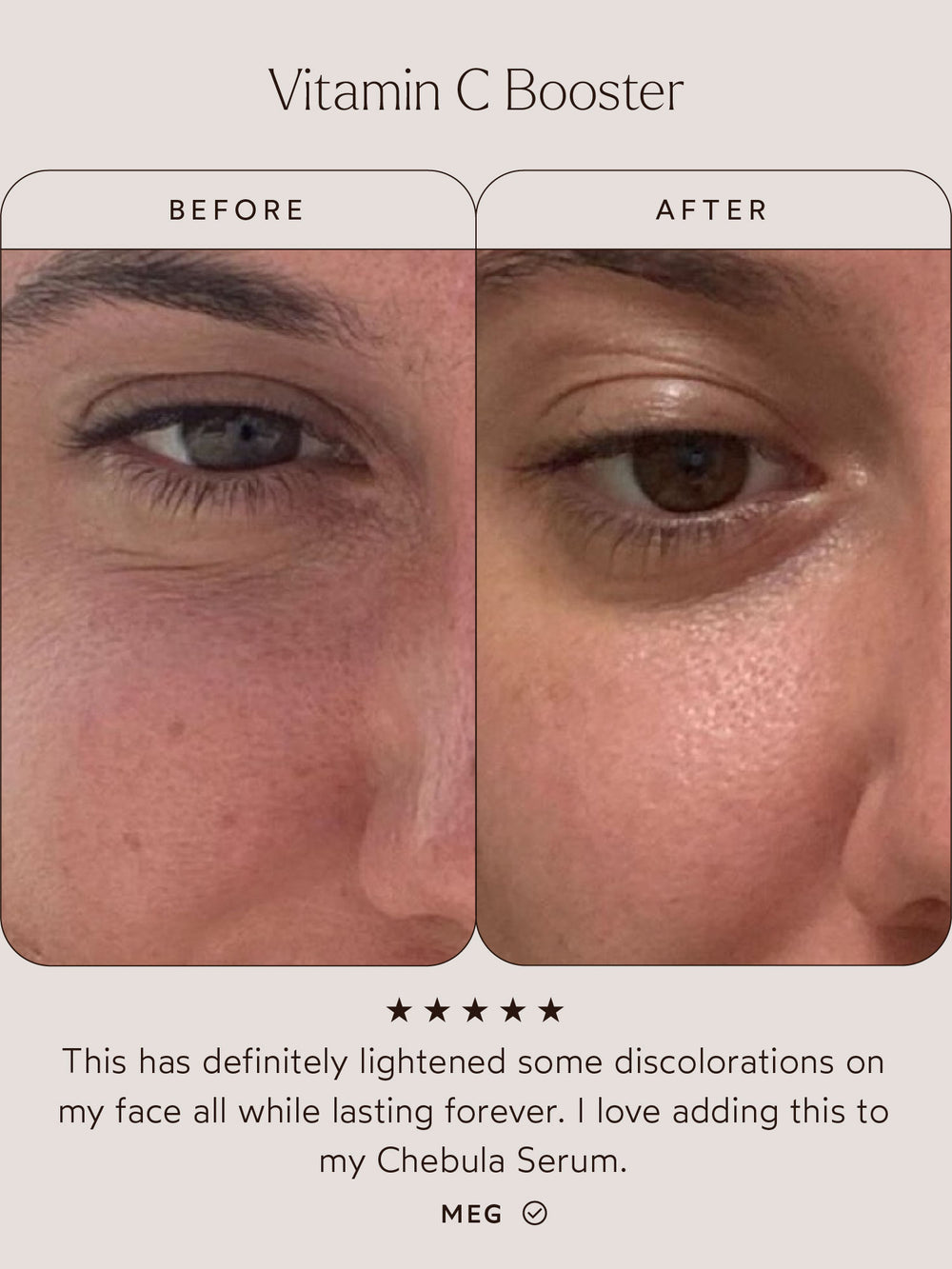 Before-and-after comparison of skin improvements with the Vitamin C Booster. The "Before" image highlights uneven skin tone and discoloration, while the "After" image shows visibly brighter, more even skin. Below, a customer review reads: "This has definitely lightened some discolorations on my face all while lasting forever. I love adding this to my Chebula Serum." – Meg. Five-star rating included.