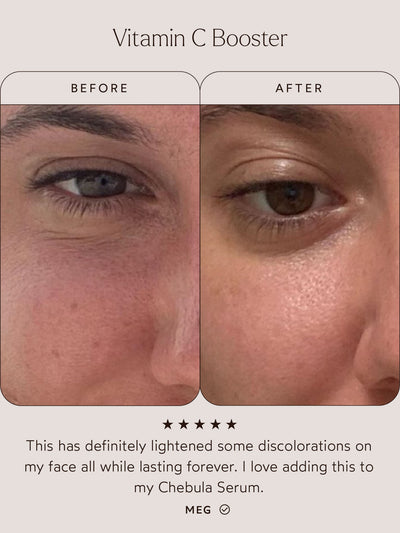 Before-and-after comparison of skin improvements with the Vitamin C Booster. The "Before" image highlights uneven skin tone and discoloration, while the "After" image shows visibly brighter, more even skin. Below, a customer review reads: "This has definitely lightened some discolorations on my face all while lasting forever. I love adding this to my Chebula Serum." – Meg. Five-star rating included.