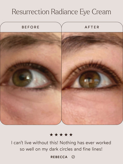 Before and after comparison of the eye area using Resurrection Radiance Eye Cream. The "Before" image shows visible dark circles and fine lines, while the "After" image reveals a brighter, smoother, and more refreshed appearance. Below the images, a testimonial reads: "I can’t live without this! Nothing has ever worked so well on my dark circles and fine lines!" – Rebecca.