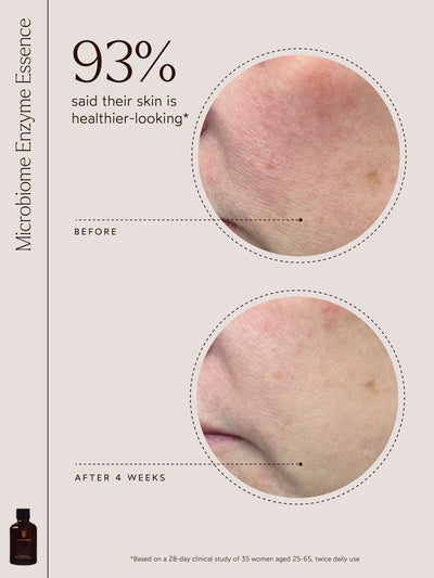 An image showing "93% said their skin is healthier-looking*" with before and after close-ups of skin improvement after 4 weeks. A Microbiome Enzyme Essence bottle is featured, with study details below.